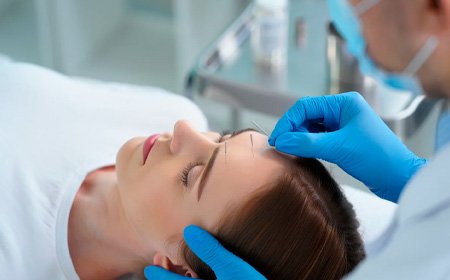 Врач делает процедуру иглоукалывания